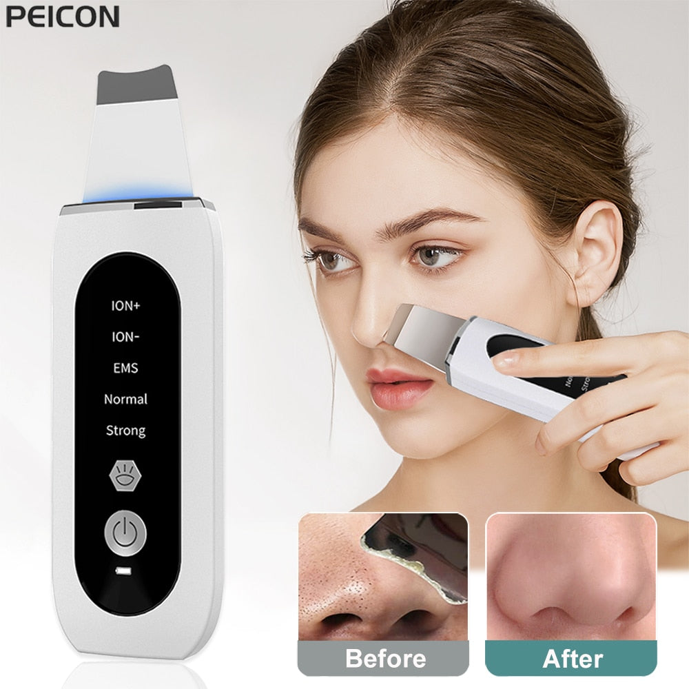 Skin Scrubber Peeling Acne Pore Cleaner Radiant Skin Reveal Ultimate Skin Scrubber Peeling Device Unlock Your Skin's True Beauty  Revitalize Your Complexion Experience Smooth